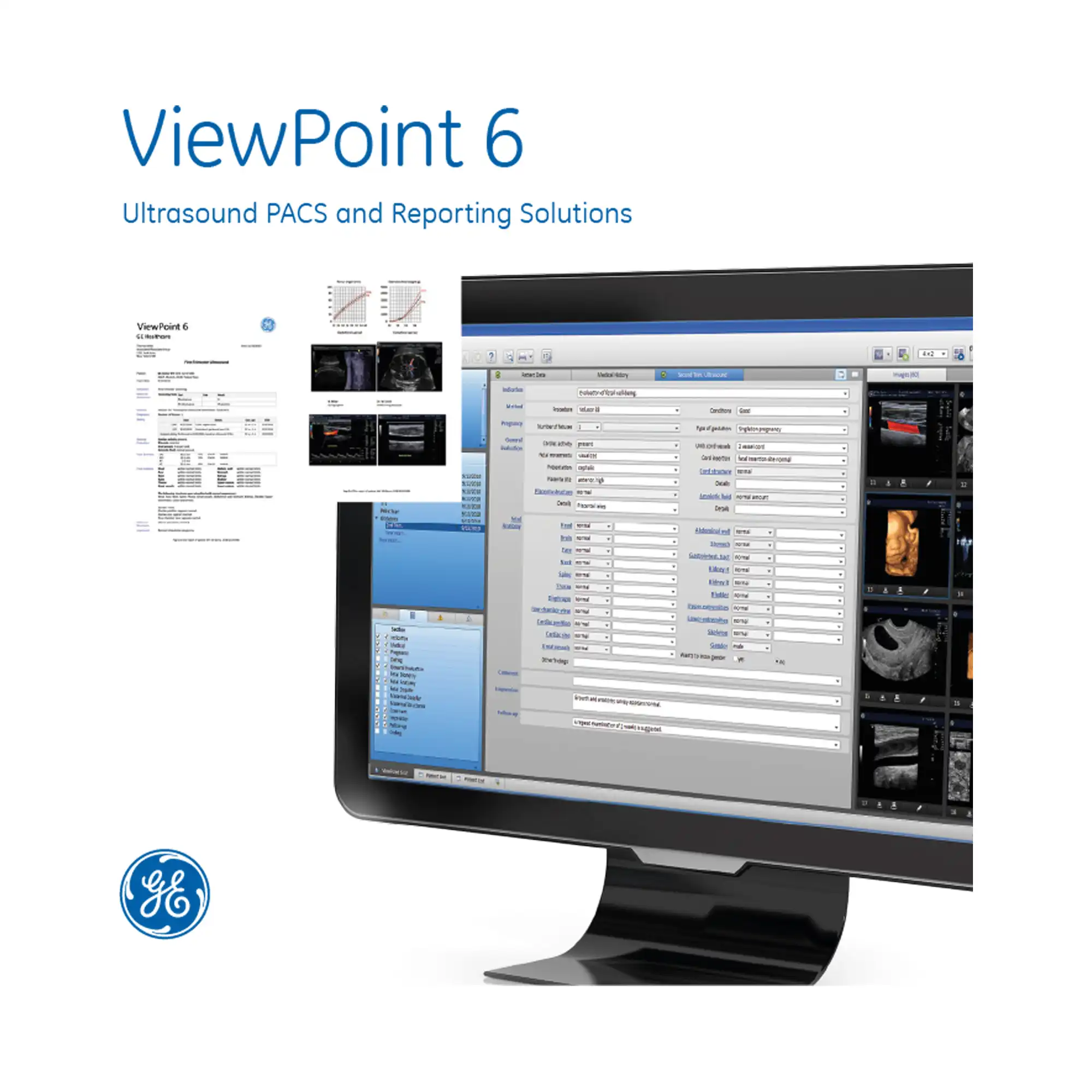 Software ViewPoint 6