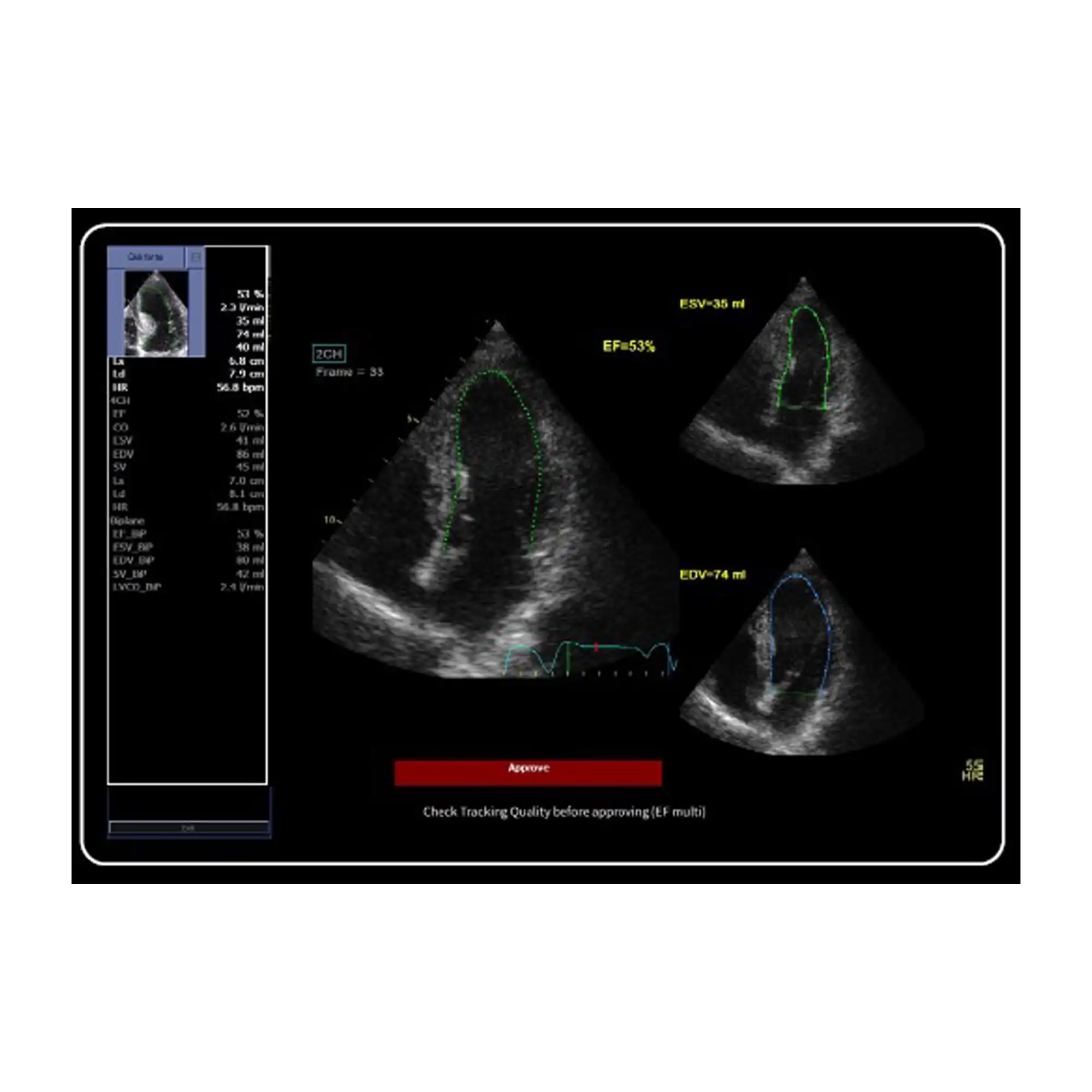 Imaging Insights