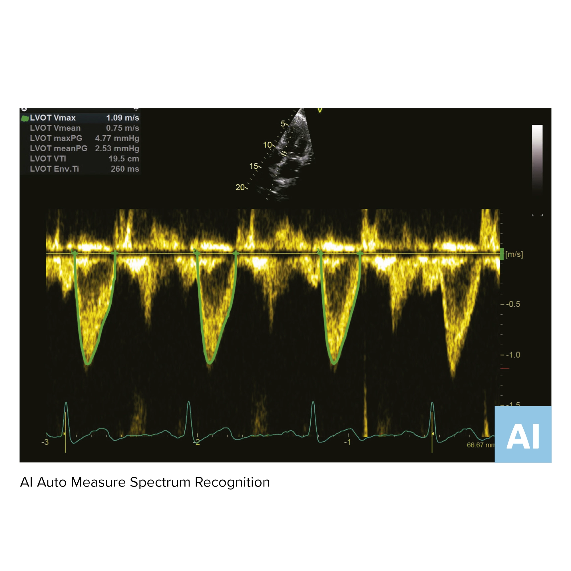 AI Auto Measure Spectrum Recognition