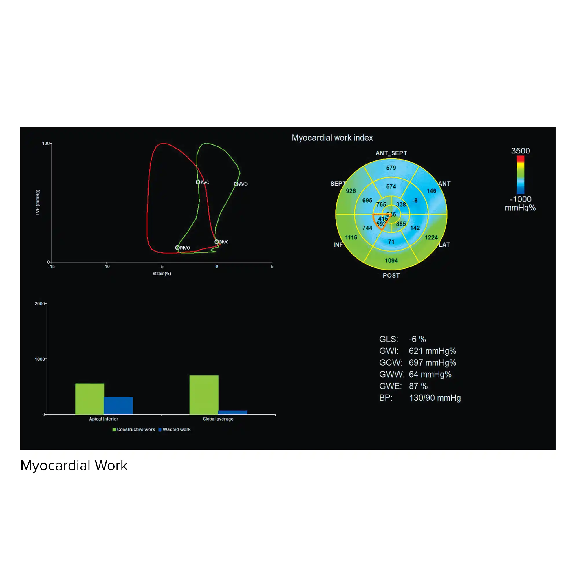 Myocardial Work