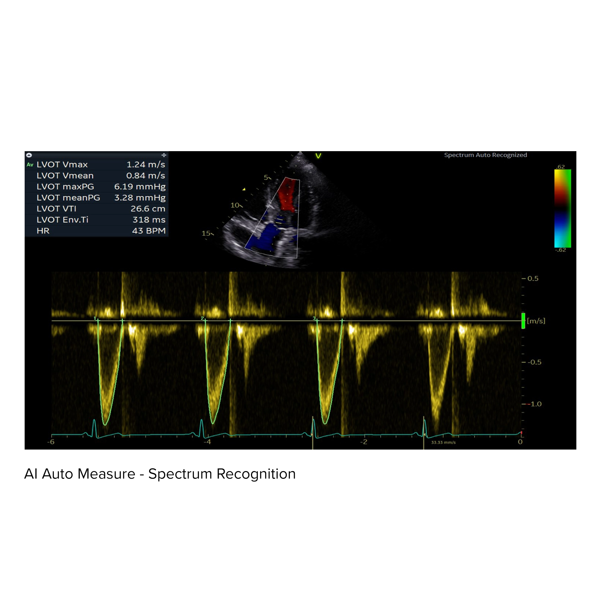 AI Auto Measure - Spectrum Recognition